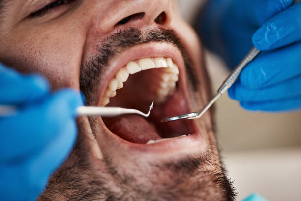 Best Chipped Tooth Repair Near Me  in Alexandria, KY